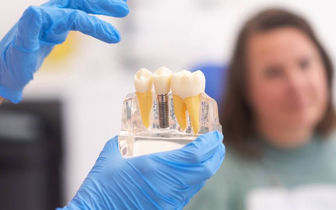 Dental Implants Guide: Benefits & Candidate Suitability